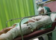 Akibat Cemburu Buta, Seorang Pria Tega Bakar Istrinya Hingga Meninggal Dunia