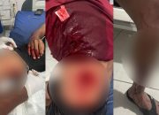 Akibat Hutang Piutang Seorang Oknum Wartawan di Balut Menjadi Korban Penusukan
