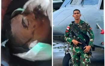 MISTERI DI BALIK PETI TERKUNCI: Luka Irisan dan 7 Lapis Plastik Mengoyak Narasi Lakalantas Pratu Samuel Warlela ​